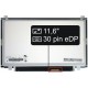 Display-ul notebook-ului Acer Aspire V5-123-12104G32NSS11,6“ 30pin HD LED Slim - Lucios